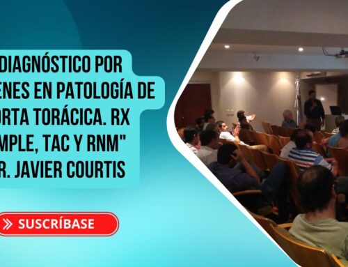 Jornada de Docencia “Diagnóstico por imágenes en patología de Aorta Torácica. Rx Simple, TAC y RNM”